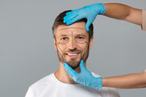 Plastic surgery incision marks on a man's face